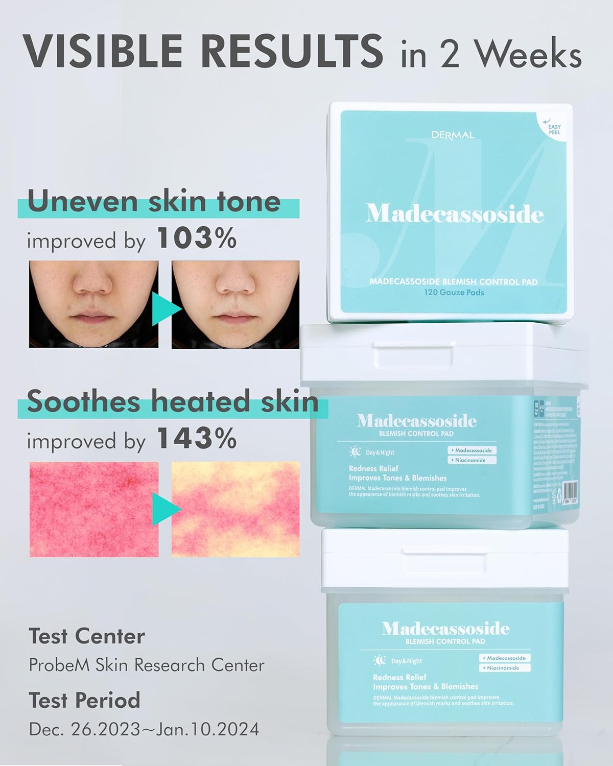 DERMAL Madecassoside Blemish Control Toner Pad - Korean Toner Pad for Blemish & Tone Improvement with Centella Asiatica - Vegan Gauze Tencel Square Pads - Travel Kit 12 Pads, 3 Pack (Total 36 Pads)
